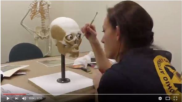 Facial Reconstruction Time Lapse